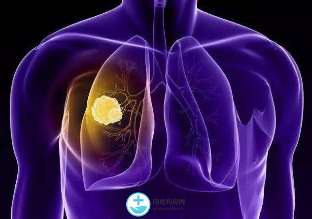 肺癌治疗中的不良反应要及时治疗